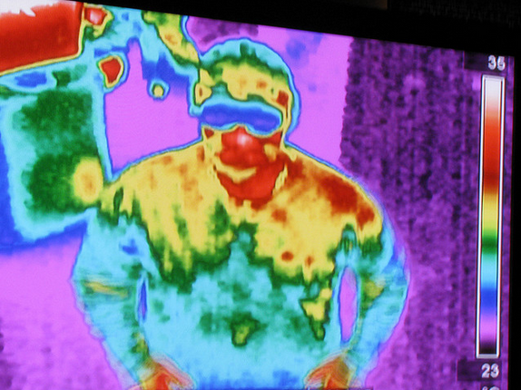 Thermal Imaging Technology